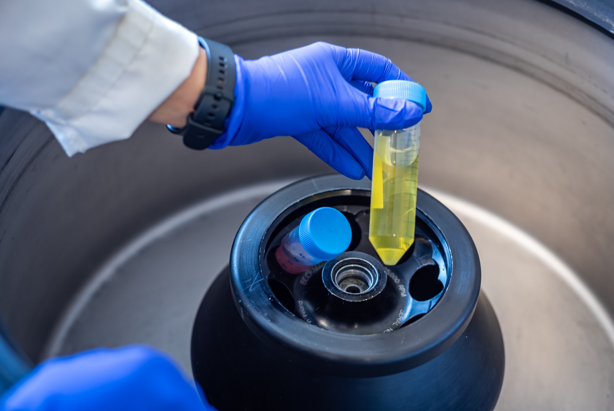 Standards Of Improved Detection Disease